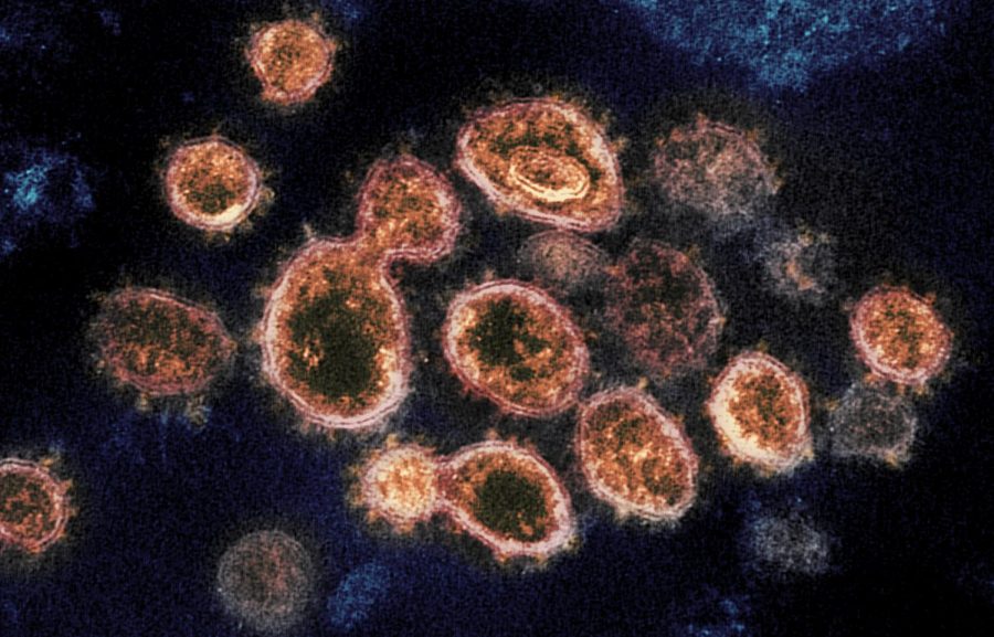 SARS-CoV-2, the virus that causes COVID-19, isolated from a patient in the U.S. Virus particles are shown emerging from the surface of cells cultured in the lab. The spikes on the outer edge of the virus particles give coronaviruses their name, crown-like. Credit: NIAID-RML; Flickr